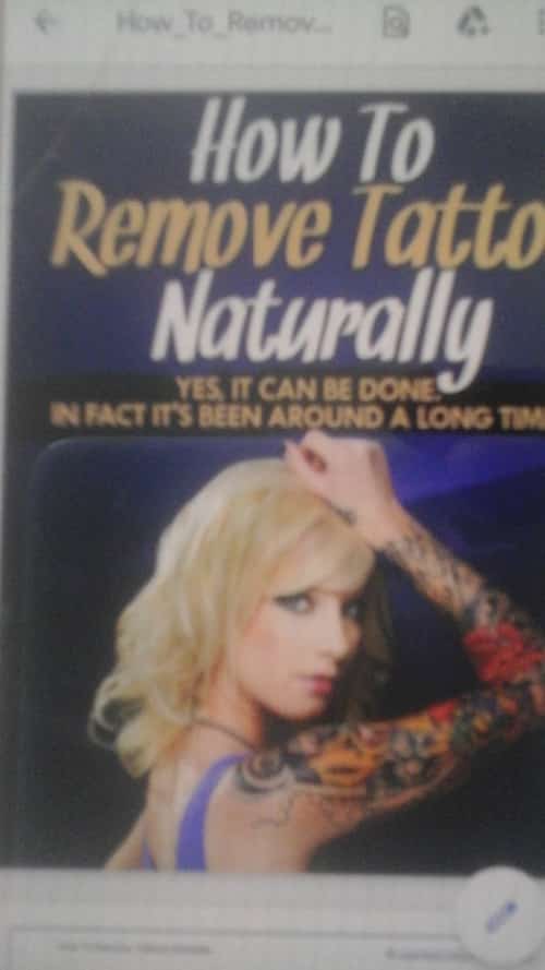 Top Cony-Laserless Tattoo Removal