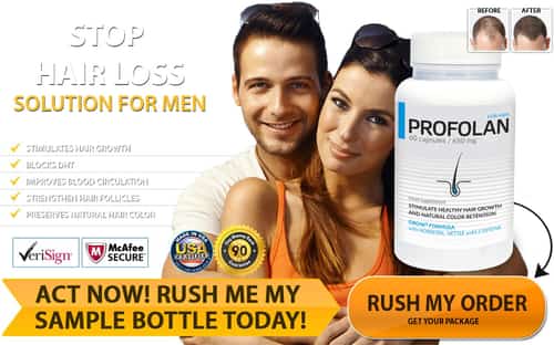 PROFOLAN - Stop Hair Loss, Price: $69.00