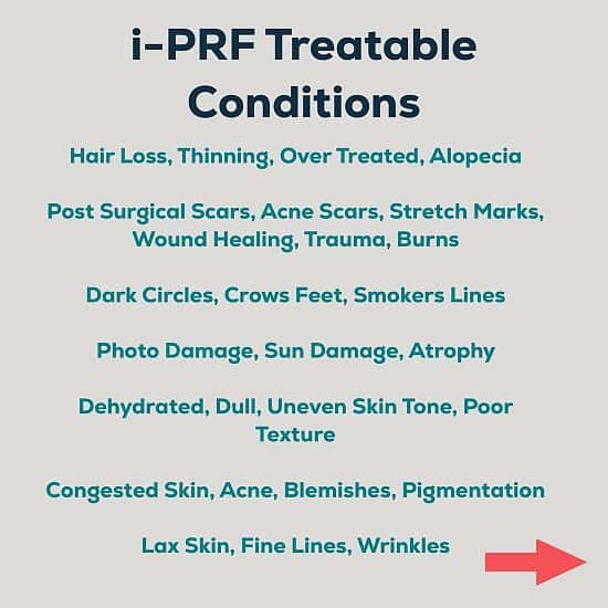 15% Off i-PRF Treatments